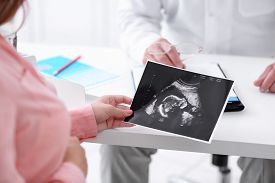 Внематочная беременность: определение, причины